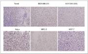 WRN antibody (mAb) tested by immunohistochemistry.