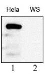 WRN antibody (mAb) tested by Western blot.