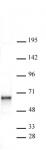 Sox11 antibody (pAb) tested by Western blot.