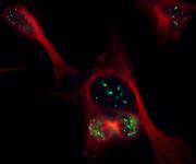 CENP-B antibody (pAb) tested by immunofluorescence.