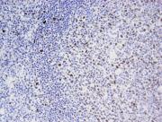 EED antibody (mAb) tested by immunohistochemistry.