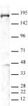 PBRM1 antibody (pAb) tested by Western blot.