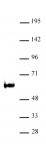 TDG / Thymine-DNA glycosylase antibody (pAb) tested by Western blot.