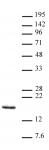 Histone H3K14me3 antibody (pAb) tested by Western blot.
