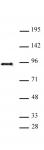 SATB2 antibody (pAb) tested by Western blot.