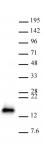 CDKN2A antibody (pAb) tested by Western blot.