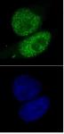 SMARCA4 antibody (mAb) tested by immunofluorescence.