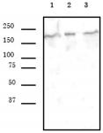SMARCA4 antibody (mAb) tested by Western blot.