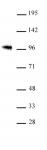 SOX6 antibody (pAb) tested by Western blot.