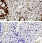 YY1 antibody (pAb) tested by immunohistochemistry.