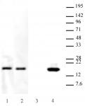 Histone H3.3K27M antibody (pAb) tested by Western blot.