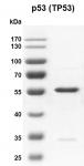Recombinant p53 (TP53) protein gel