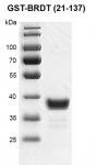 Recombinant BRDT (21-137) protein, GST-Tag protein gel