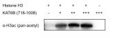 Recombinant KAT6B / MORF (718-1008) protein activity assay