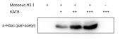 Recombinant KAT8 / MYST1 protein activity assay