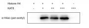 Recombinant KAT8 / MYST1 protein activity assay