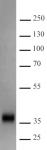 Recombinant SARS-CoV-2 Spike protein, S1 (aa319-541) protein gel.