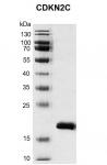 Recombinant CDKN2C protein