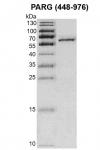 Recombinant PARG (448-976) protein Coomassie gel