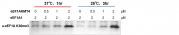 Activity assay for eEF1AKMT4 protein activity