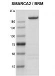Recombinant SMARCA2 / BRM protein