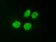 AbFlex<sup>&reg;</sup> Histone H3K9ac antibody (rAb) tested by immunofluorescence.