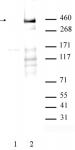 AbFlex<sup>&reg;</sup> ATM phospho Ser1981 antibody (rAb) tested by Western blot.