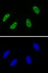 AbFlex<sup>®</sup> RNA Pol II CTD phospho Tyr1 antibody (rAb) tested by immunofluorescence.