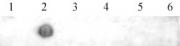 AbFlex<sup>&reg;</sup> N6-Methyladenosine (m6A) antibody tested by Dot blot.