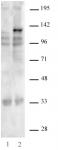 AbFlex<sup>®</sup> SaCas9 antibody (rAb) tested by Western blot.