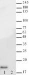 AbFlex<sup>&reg;</sup> Histone H3K14ac antibody (rAb) tested by Western blot.