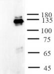 AbFlex<sup>®</sup> AHR antibody (rAb) tested by immunoprecipitation.
