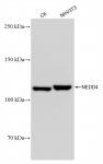 NEDD4 antibody (rAb), 100 µg tested by Western blot.